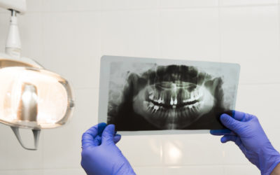 Root Canal Options You Should Know