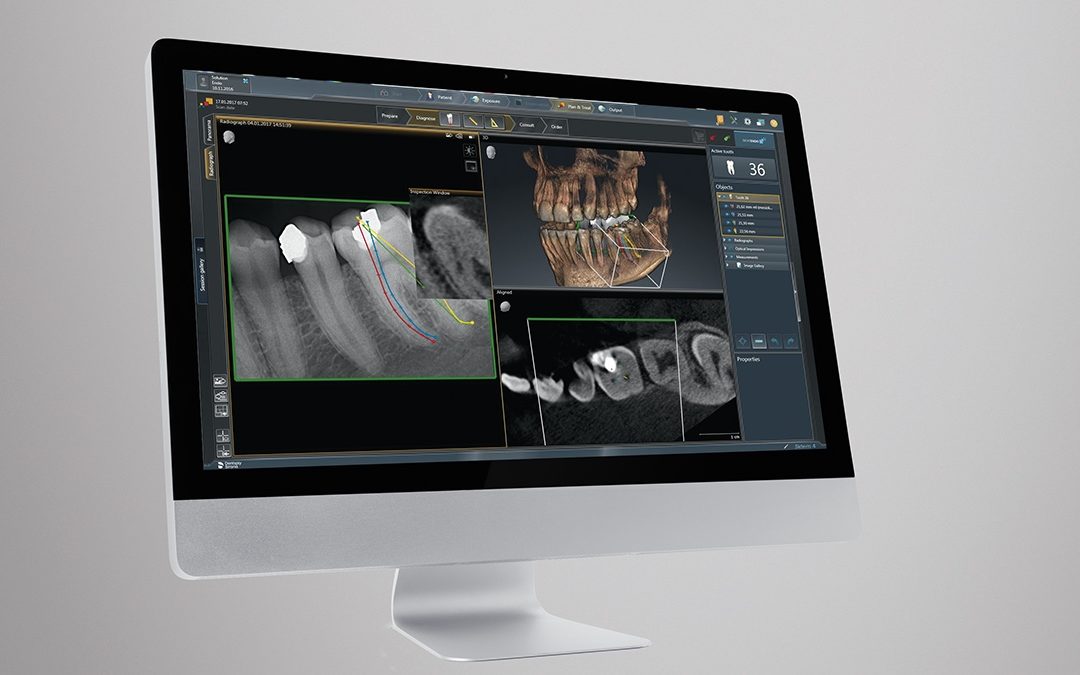 Do You Need Dental 3D Imaging?