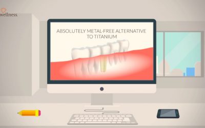 All You Need to Know about Zirconia Dental Implants – Part 2