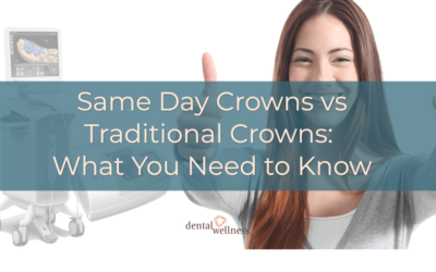 What are same-day crowns, and is it even possible?