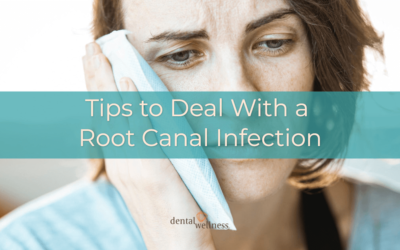 Tips to deal with a root canal infection