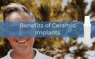Benefits of Ceramic Implants