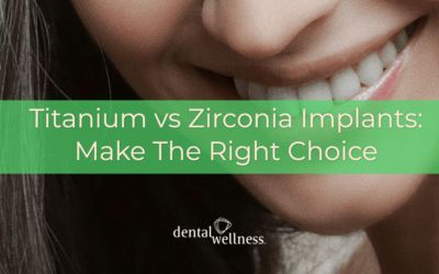 Titanium vs Zirconia Implants: Make The Right Choice