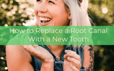 How to Replace a Root Canal With a New Tooth