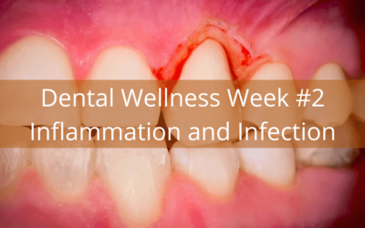 Dental Wellness Week #2 – Inflammation and Infection