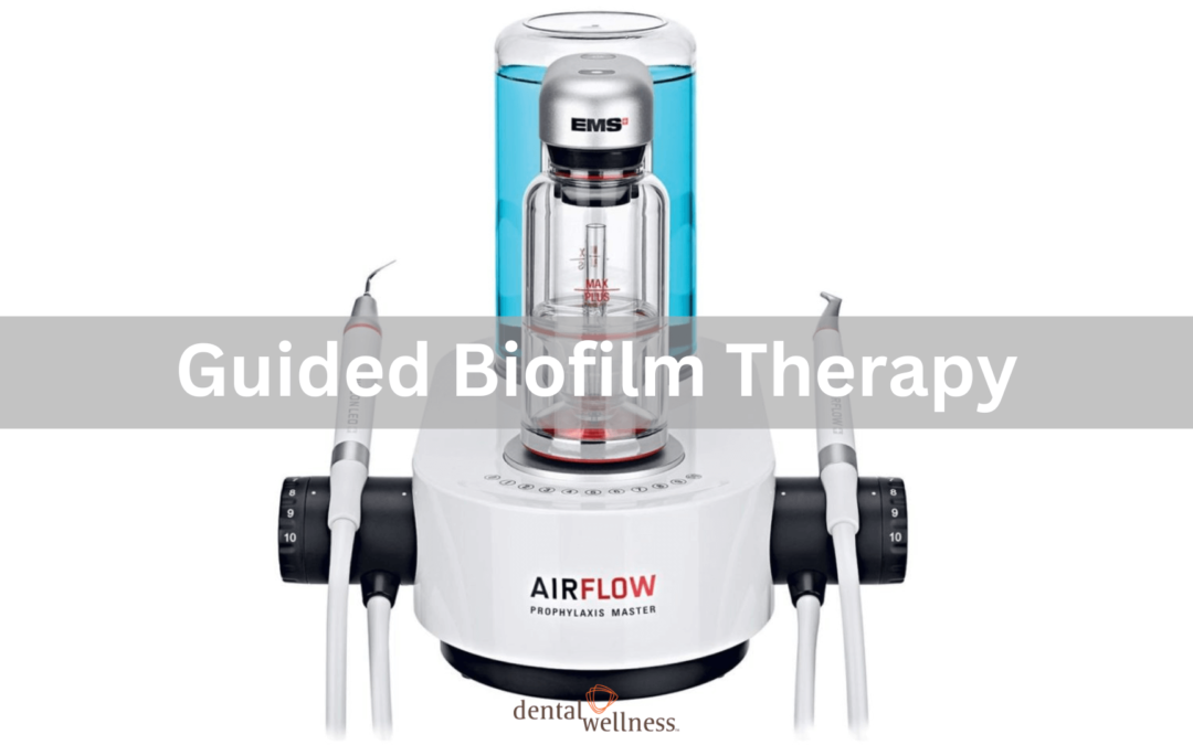 Guided Biofilm Therapy