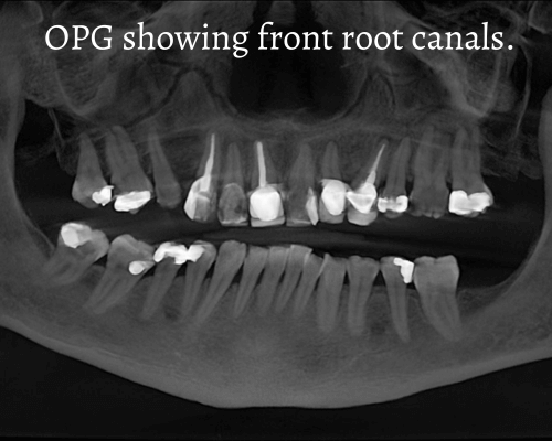 CBCT