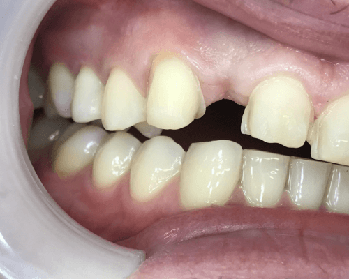 Case Study S.D. Aesthetic Smile