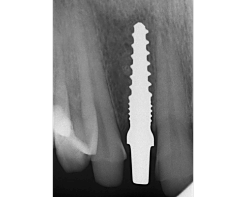 Case Study S.D. Aesthetic Smile