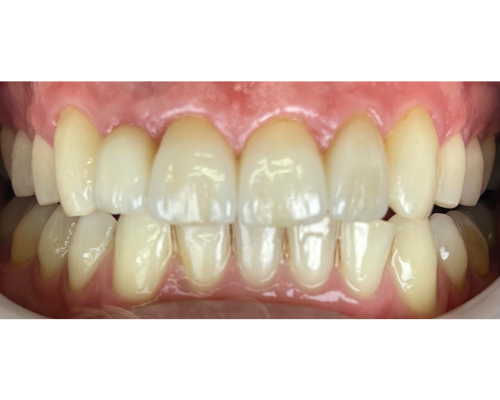 Case Study S.D. Aesthetic Smile